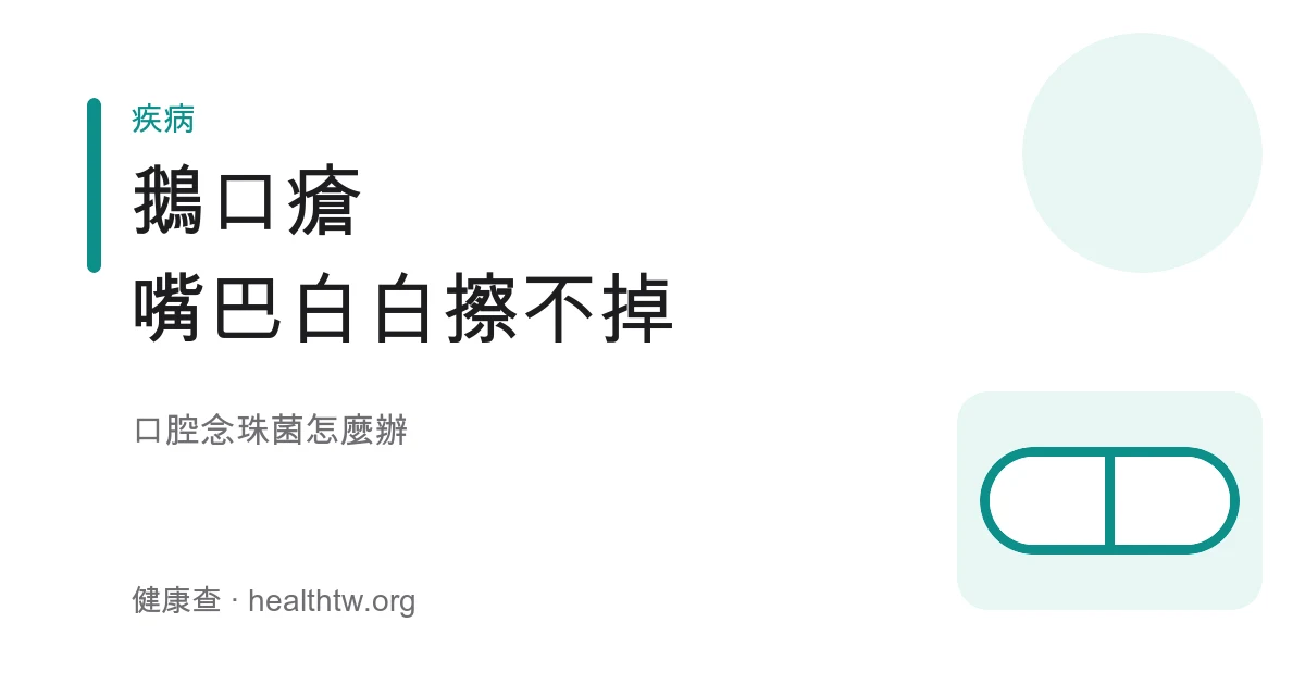 嬰兒口腔內舌頭與頰內側白色念珠菌斑塊，與奶垢區別的鵝口瘡衛教示意圖